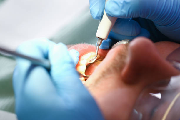 Best Emergency Root Canal Therapy in Mount Ora, OH